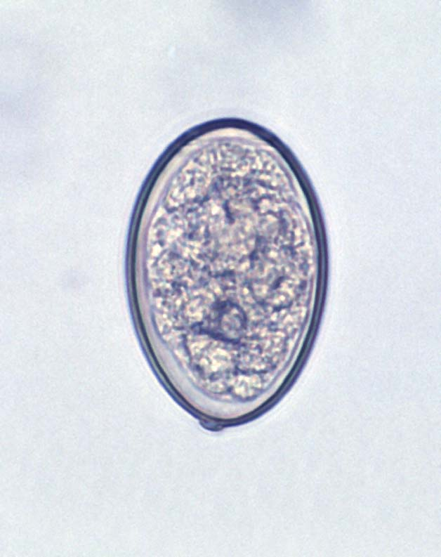 <p>55-65 x 38-42 micrometer</p><p>Smaller than Fasciola &amp; Paragonimus eggs</p>