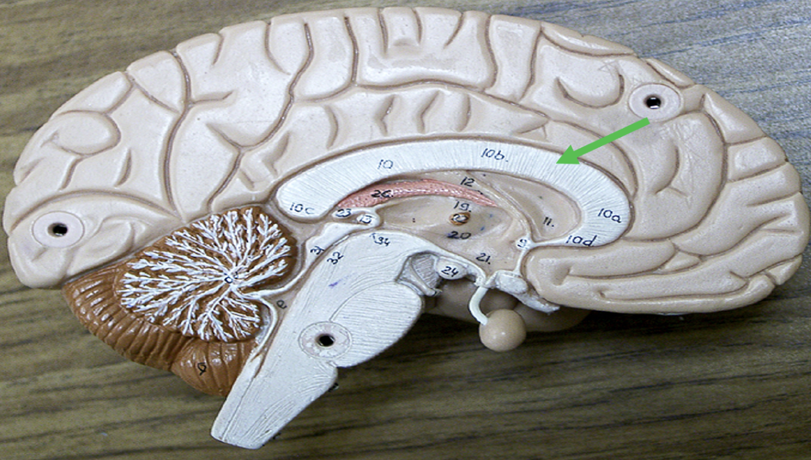 <p><span>Identify the area of the brain indicated by the pointer.</span></p>
