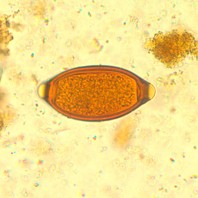 <p>Identify the organism</p>