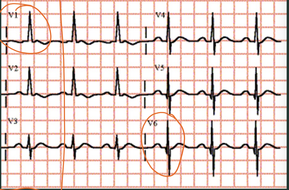 <p>What type of hypertrophy?</p>