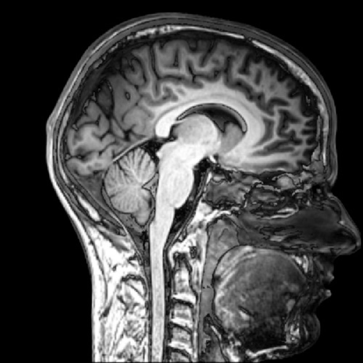 <p>Uses magnetic fields to produce detailed images.</p>