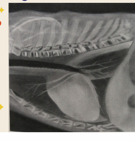 <p>Tricuspid insufficiency</p>