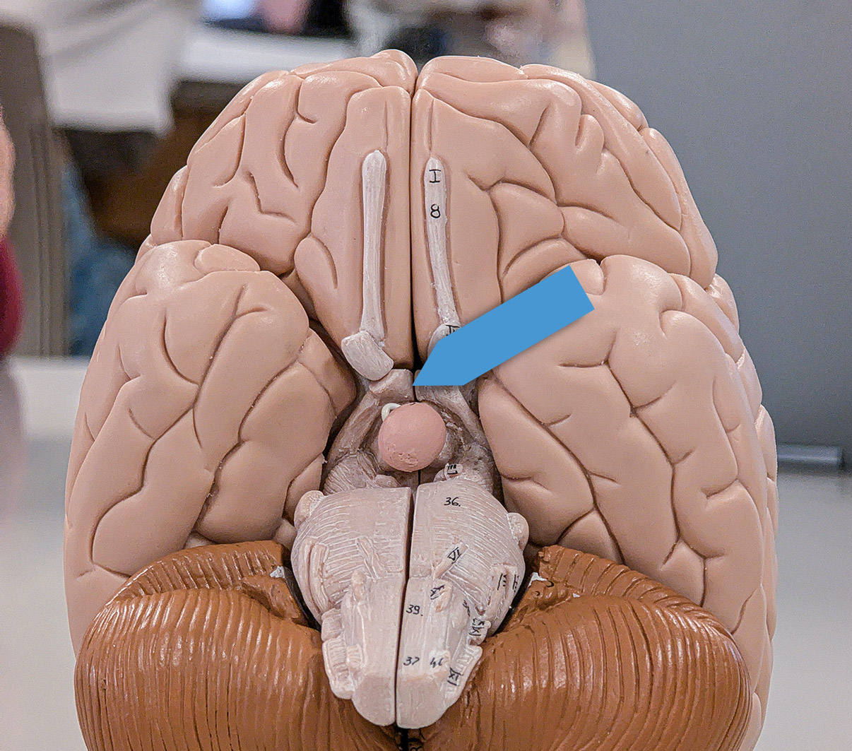 <p>Identify the structure at the pointer.</p>