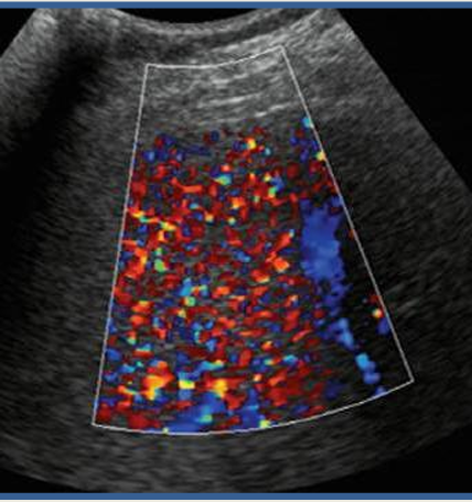 <p>what is happening in this image?</p>