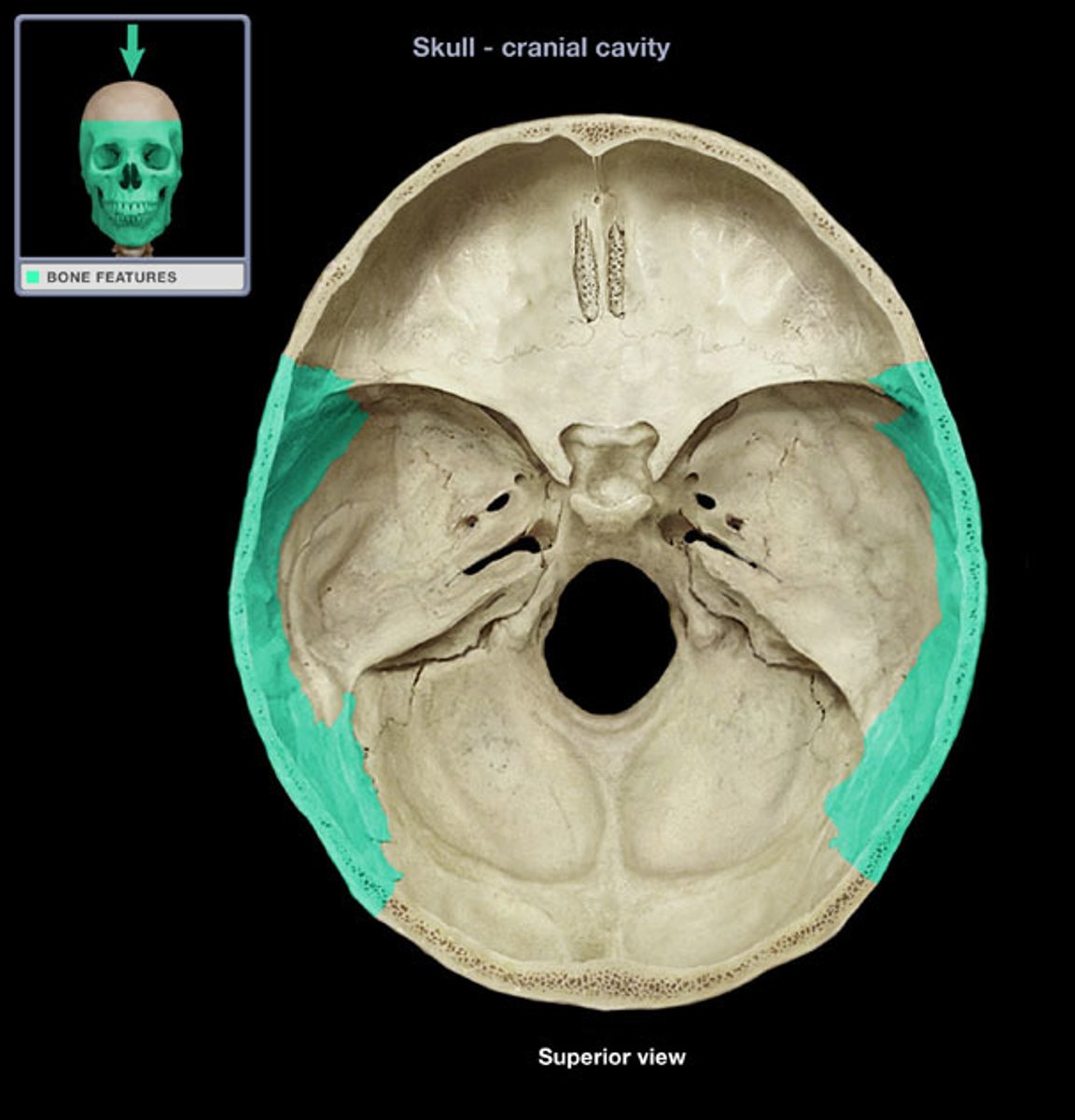 <p>What bone is this?</p>