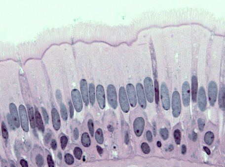 <p>identify this tissue</p>