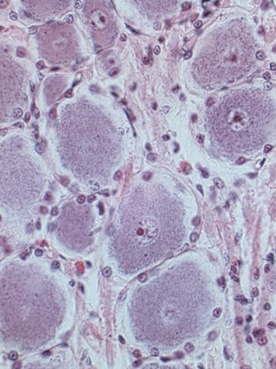 <p>Are these unipolar or multipolar neurons? </p>