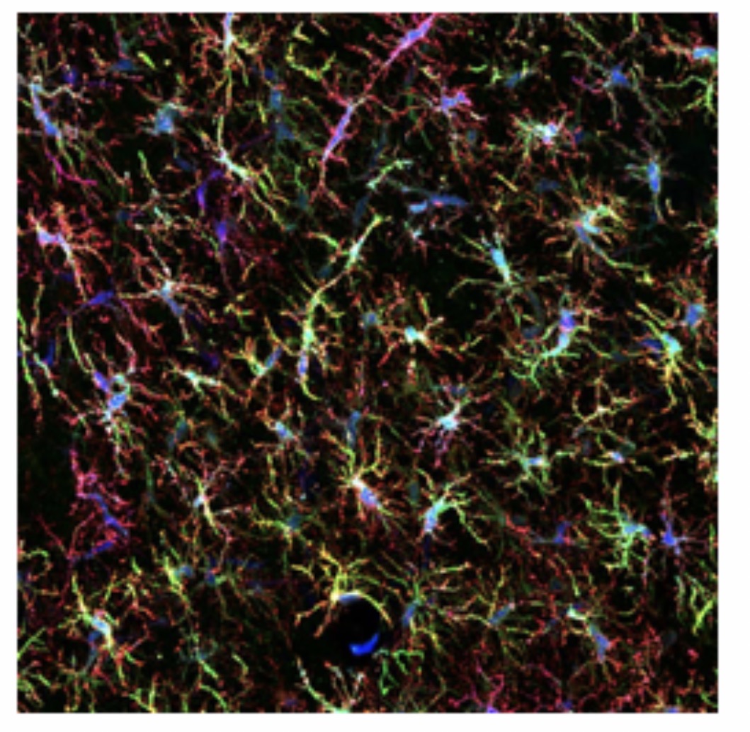 <p>Microglia Cell: Function: <span>Act as CNS immune cells; remove debris and pathogens. Small cells with elongated bodies, elongated nuclei with dense chromatin </span></p>