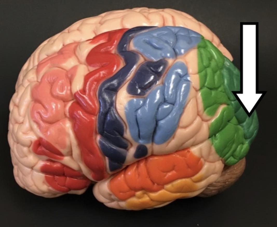 <p>What lobe is the arrow pointing to?</p>