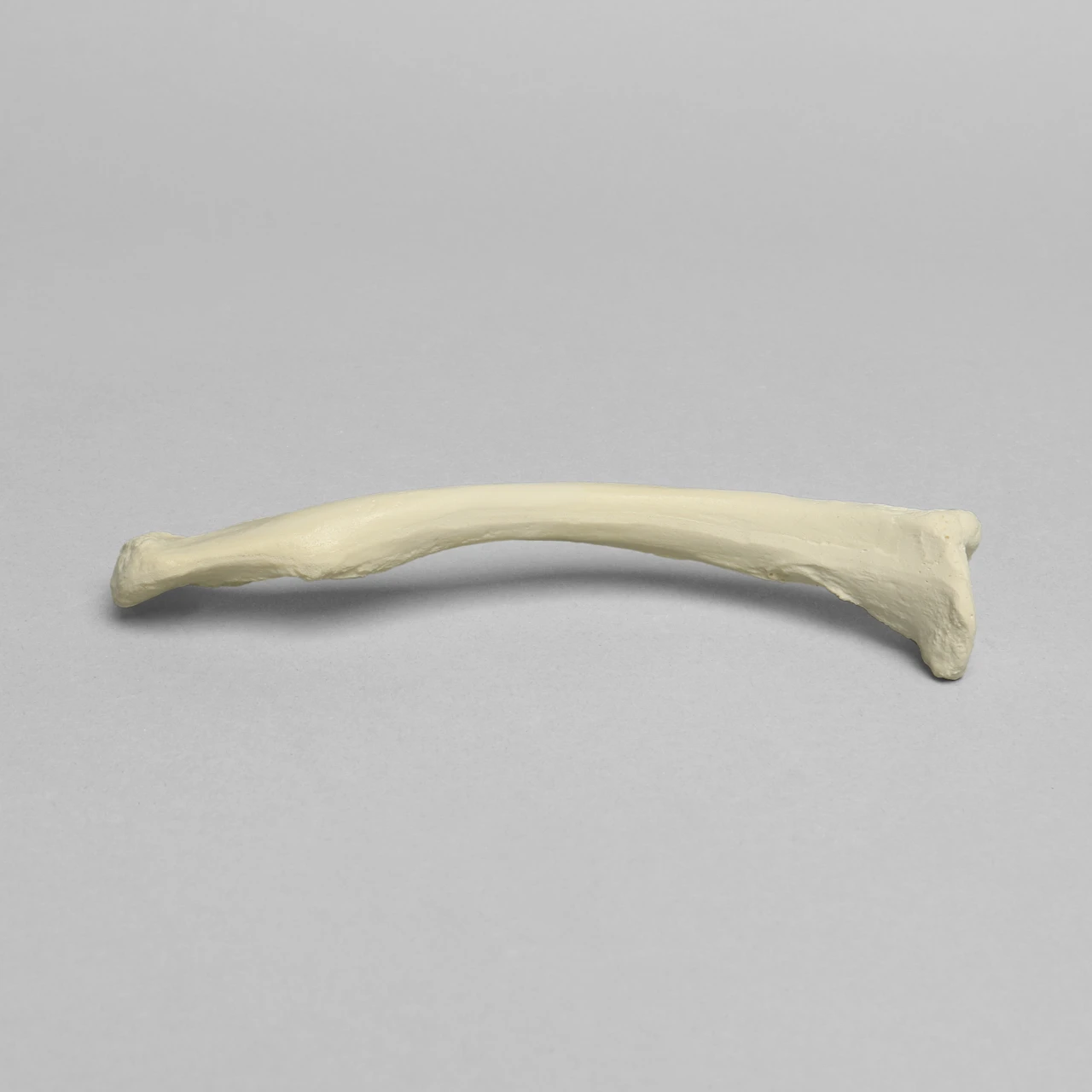 <p>What bone is this?</p>