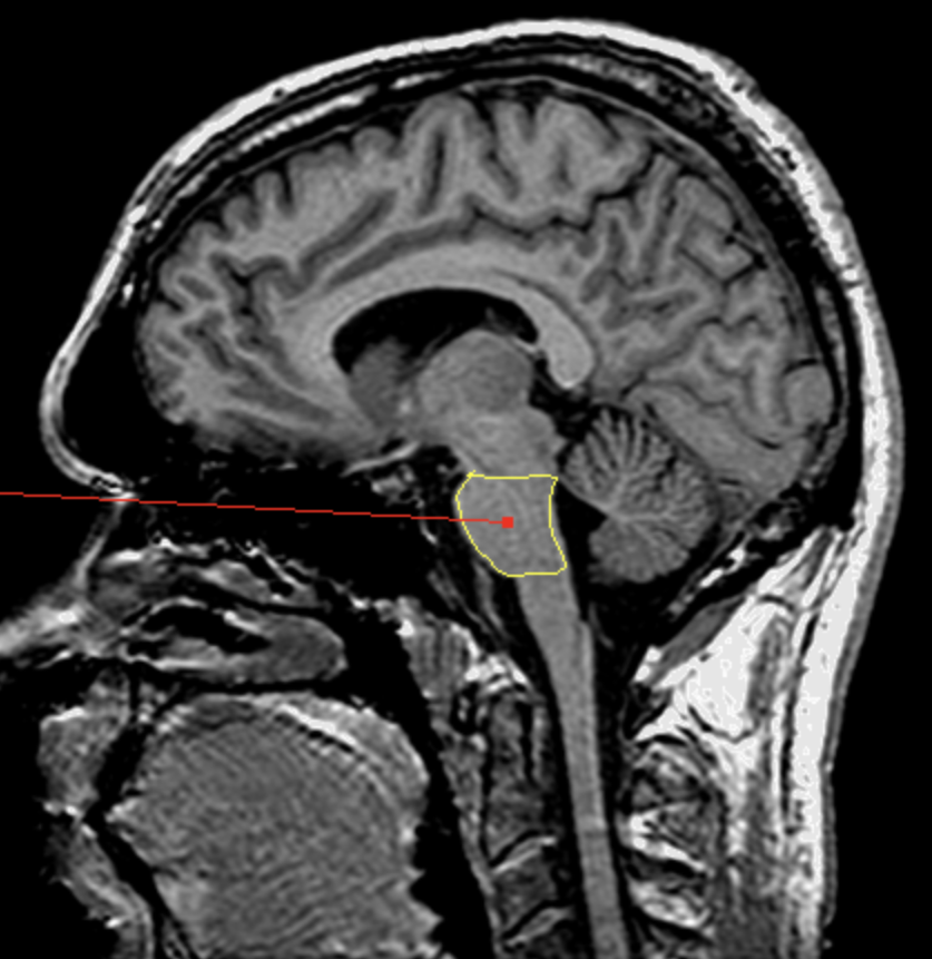 <p>What is the area highlighted called?</p>