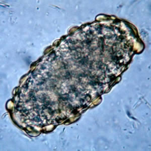 <ul><li><p>elongated </p></li><li><p>have mammillations </p></li></ul><p></p>