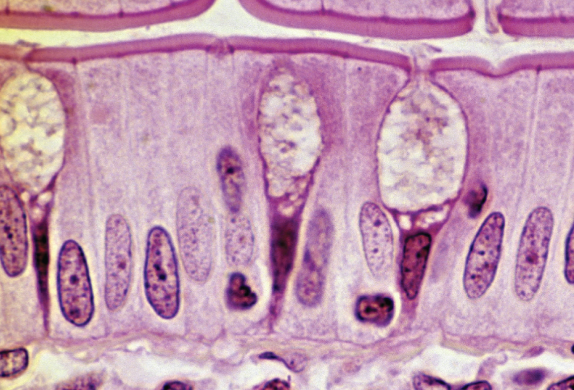 <p>What is the class and shape of this epithelia</p>