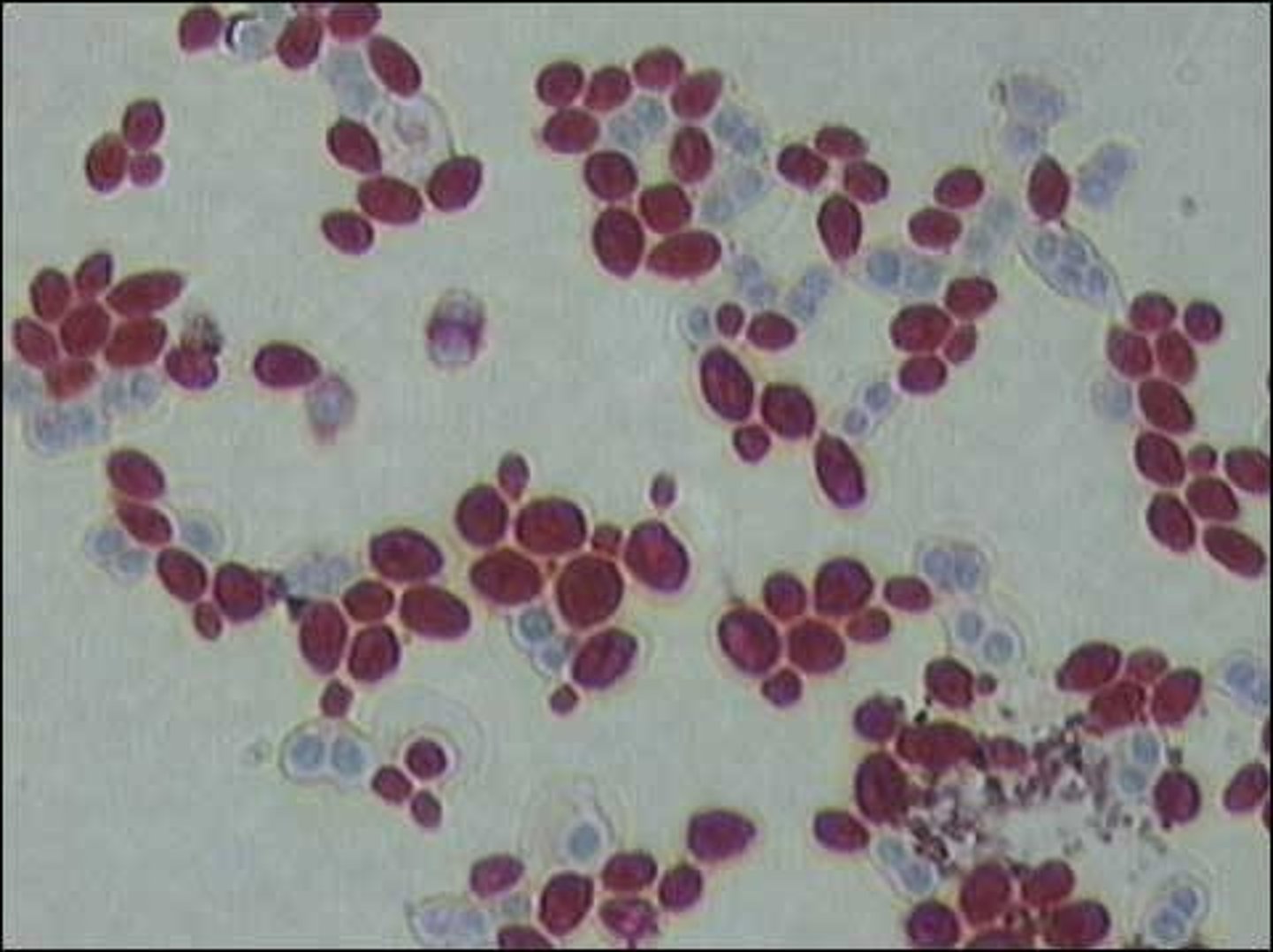 <p>Short pseudohyphae with oval multi-budding blastoconidia</p>