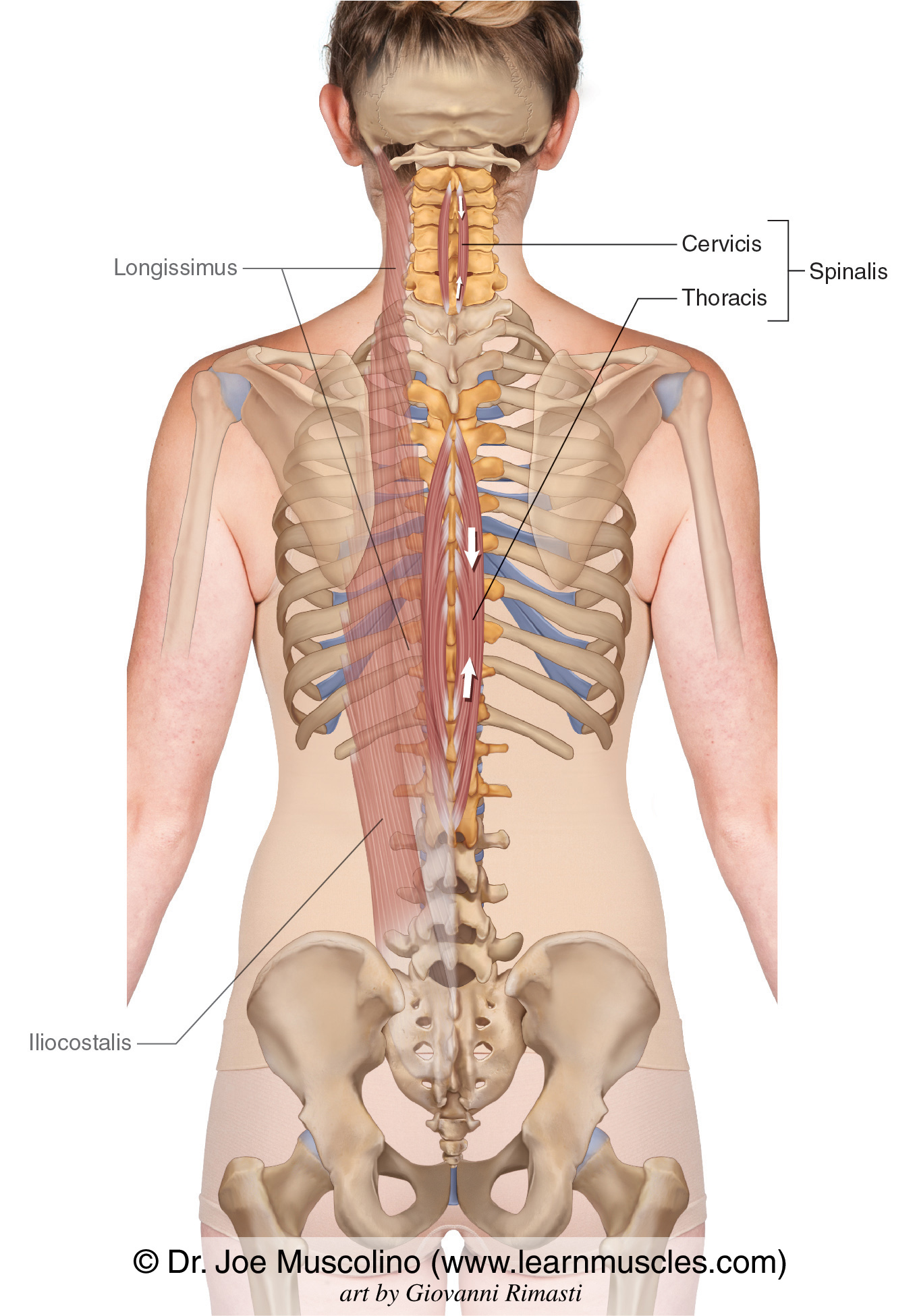 <ul><li><p>the most medial of the spinal erectors</p></li><li><p>made of 3 parts: capitis, cervicis, and thoracis</p></li></ul><p></p><p>origin → capitis: spinous processes of C7-T1 vertebrae</p><p>          → cervicis: spinous processes of C7-T1 vertebrae; nuchal ligament</p><p>          → thoracis: spinous processes of T11-L2</p><p>insertion → Capitis: occipital bone (midline)</p><p>               → cervicis: spinous processes of C2-C4 vertebrae</p><p>               → thoracis: spinous processes of T2-T8 vertebrae</p><p>action → bilateral contraction extends the head, cervical, and thoracic spine; unilateral contraction laterally flexes the cervical and thoracic spine (ipsilateral)</p><p>innervation → lateral branches of posterior rami of spinal nerves</p><p>blood supply → posterior branch of intercostal artery, deep cervical artery, muscular branches of vertebral artery </p>