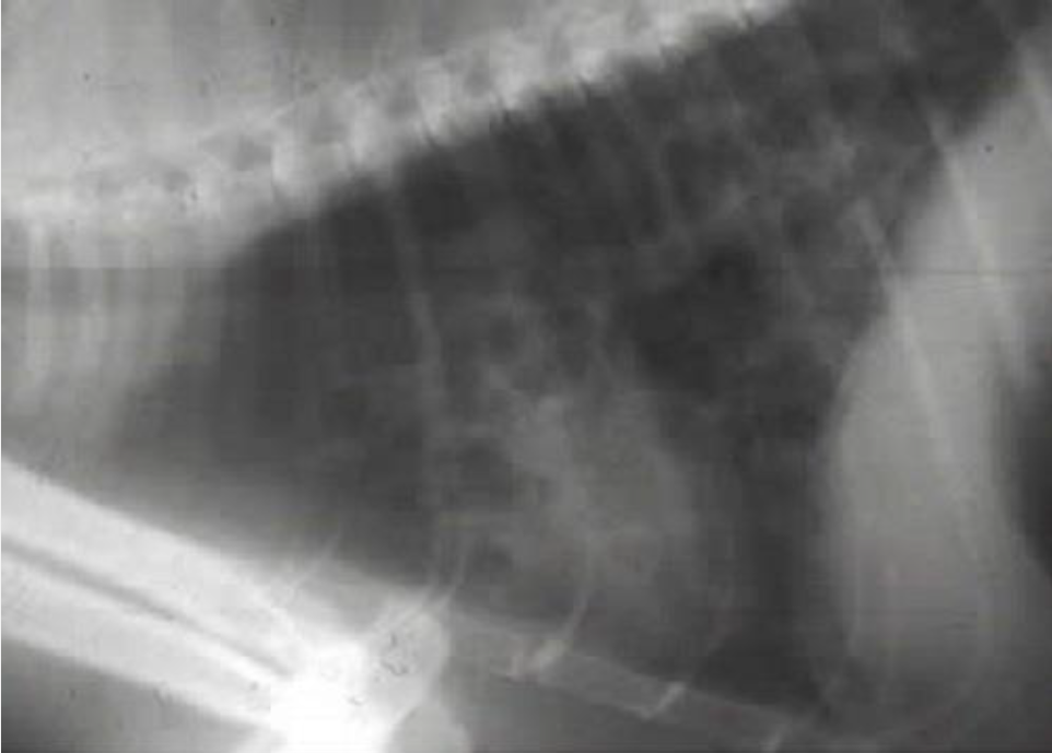 <p><em>Paragonimus</em>: Disease</p>