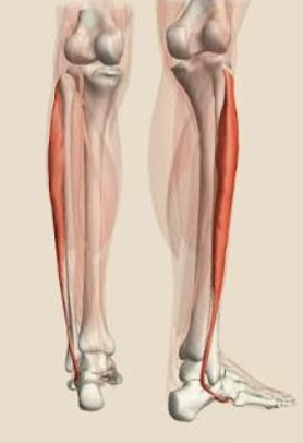 <p>Which muscle is this?</p>