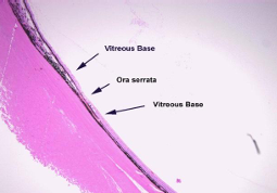<ul><li><p>spans from 2mm anterior to ora serrata &amp; 2-4mm behind ora serrata</p></li><li><p>peripheral retina is susceptible to detachment from <strong>continued traction</strong> from the vitreous</p></li></ul><p></p>