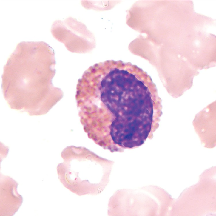 <p>What WBC precursor is this?</p>