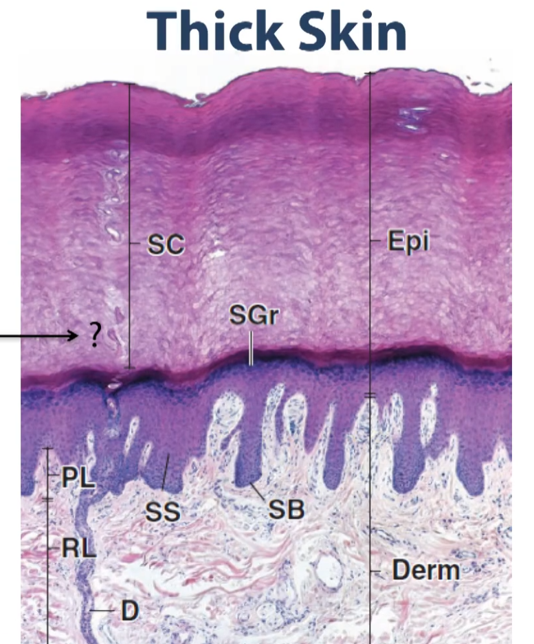 <p>So we have the thick skin again to illustrate all that together. So we have our epidermal layer, and our epidermal layer is divided into multiple sub-layers. </p><p>We have our coordified layer (stratum corneum), </p><p>then Stratum granulosum (granular layer)</p><p>Stratum spinosum (SS, spiny cell layer)</p><p>Then the layer that is closet to the basement membrane and the connective tissue, it’s a single layer of cells known as the basal layer or the stratum basale. </p><p>This being thick skin, we have an extra layer within the keratinized portion right, above the stratum granulosum, which we call the lucid layer (stratum lucidum) (dark pink over the stratum granulosum), and we will expand on this a little bit later during the lecture. </p><p>As you can see then, below the basal layer of the stratum basale, what we have is the dermis, and the dermis is subdivided into two layers, the superficial dermis (the one that is immediately under our skin) and the dense irregular connective tissue. </p><p>The layer of the dermis that is loose connective tissue is called the papillary layer, and the layer of the dermis that is dense, irregular connective tissue is termed reticular layer of the dermis.</p><p>So those are all the layers that make up the integument in this cross section. So we are going to talk about all the features of all these layers and the specialized cells contained within. </p>