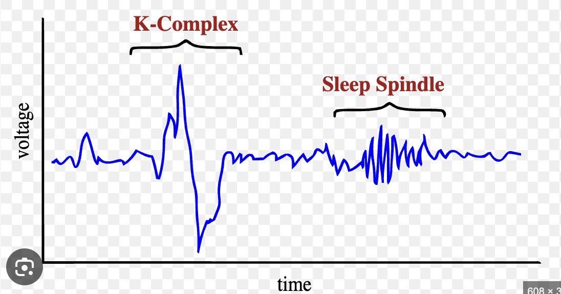 <p>Stage 1<br>=Phase between wakefulness and sleep</p><p>Stage 2<br>=A light sleep, heart rate slows and body temparature drops<br><br>theta waves の方がamplitudeでかい<br>Stage 1 NREM (N1)</p><ul><li><p><strong>The Transition:</strong> This is the "theta wave" phase. It’s the brief period where you are drifting off.</p></li><li><p><strong>Key Features:</strong> * <strong>Alpha waves</strong> (relaxed wakefulness) transition into <strong>theta waves</strong> (lower frequency, higher amplitude).</p><ul><li><p>It is very easy to wake someone up from this stage.</p></li><li><p>People often experience <strong>hypnic jerks</strong> (that feeling of falling) or vivid sensory hallucinations</p></li></ul></li></ul><p>Stage 2 NREM (N2)</p><ul><li><p><strong>The "True" Light Sleep:</strong> Your body officially enters a sleep state, and you spend about <strong>50% of your total sleep time</strong> here.</p></li><li><p><strong>Key Features:</strong></p><ul><li><p><strong>Physical changes:</strong> Heart rate slows, and body temperature drops significantly.</p></li><li><p><strong>Brain activity:</strong> This is the most important part for exams! Look for <strong>Sleep Spindles</strong> (rapid bursts of high-frequency brain waves) and <strong>K-complexes</strong> (very high amplitude pattern of brain activity).</p></li><li><p><strong>Function:</strong> Scientists believe sleep spindles are related to <strong>processing memories</strong>.</p></li></ul></li></ul><p></p>