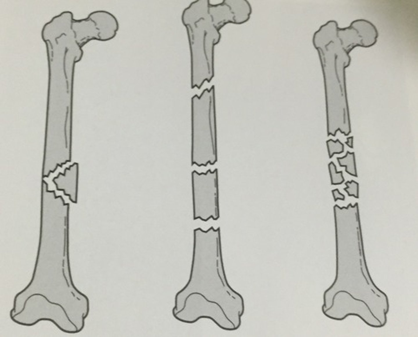 <p>more than 2 fragments</p>