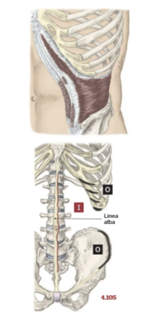 <p>What muscle is this?</p>