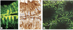 <p>What is the general shape of Sertoli cells?</p>