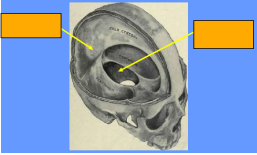 <p>Label this image </p>