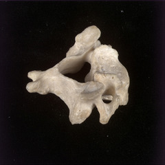 <p>Name of vertebrae and #bones</p>
