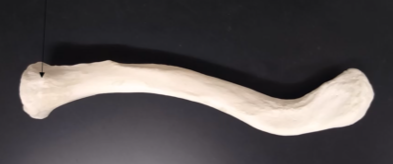 <p>What is this bone?</p>