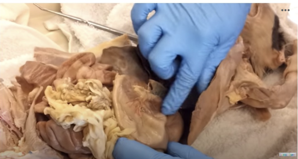 <p>identify the organ at the end of the professors right index finger</p>