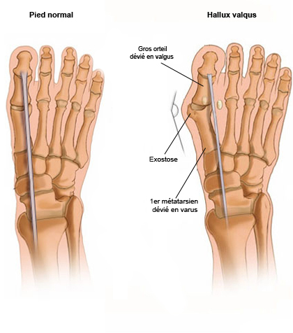 <p>What injury / condition? </p>