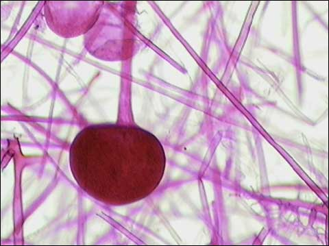 <p>What cell slide is this, and is it a prokaryote?</p>