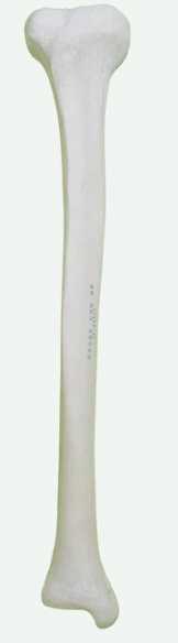 <p>Name the bone and its chirality (left vs right?)</p>