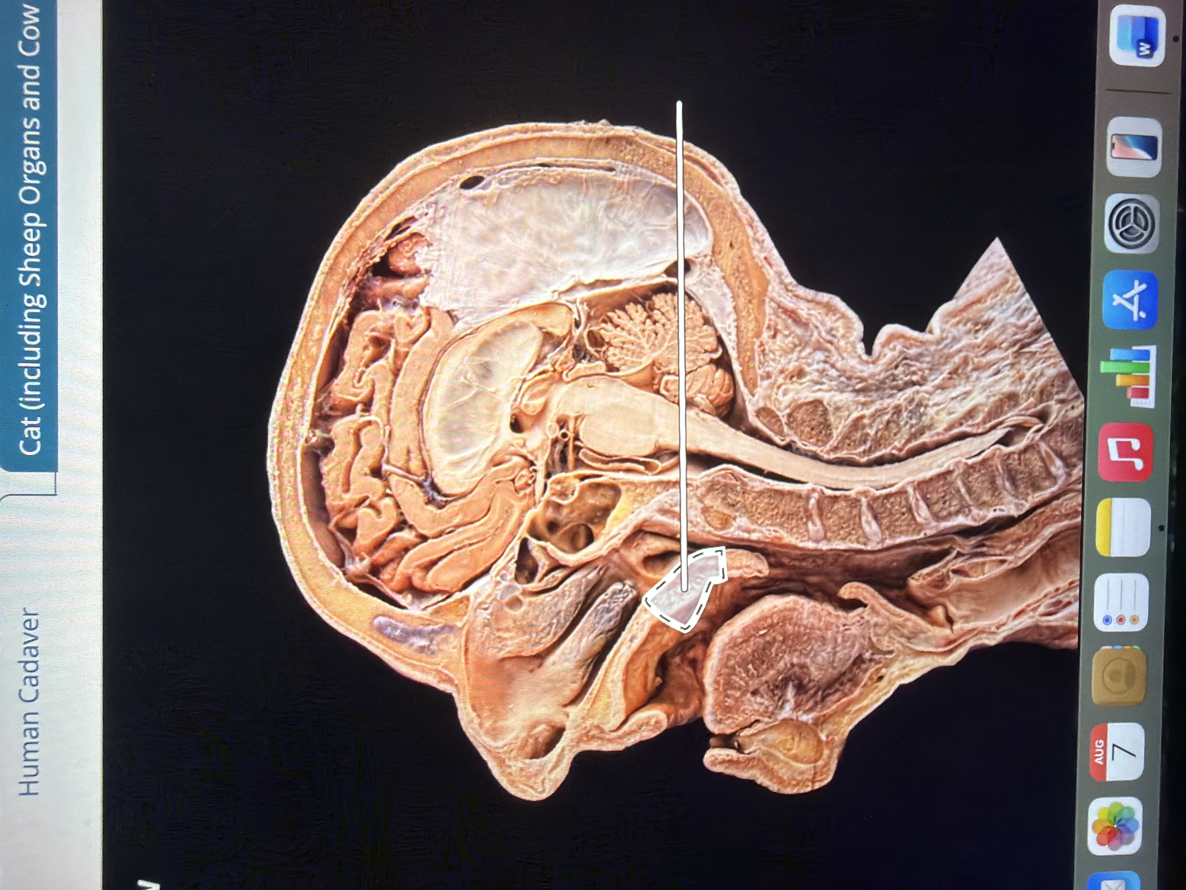 term image