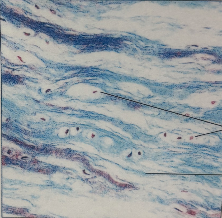 <p>fibrocartilage</p>