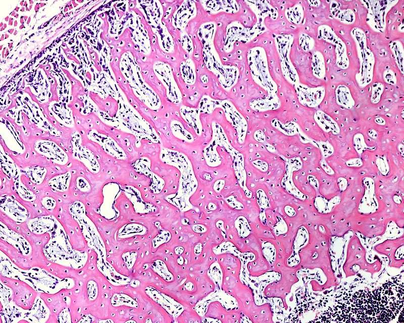 <ul><li><p>irregular</p></li><li><p>weak</p></li><li><p>small trabeculae</p></li><li><p>produced rapidly eg in fracture healing, intramembranous/endochondral ossification)</p></li></ul><p></p>