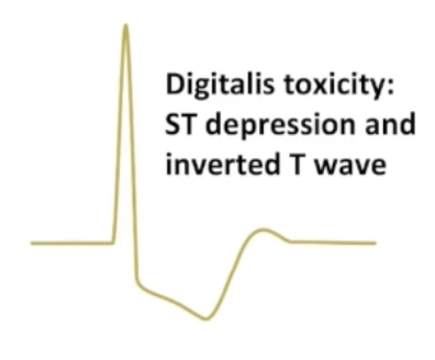 <ul><li><p>Activates vagal nerves</p></li><li><p>Slows signals from SA node</p></li><li><p>Slows AV conduction</p></li><li><p>Prolongs AV node refractory period</p></li><li><p><strong>Positive inotrope: used to treat heart failure</strong></p></li><li><p>Toxicity: nausea/vomiting, neurological effects, tachyarrhythmia</p></li></ul><p></p>