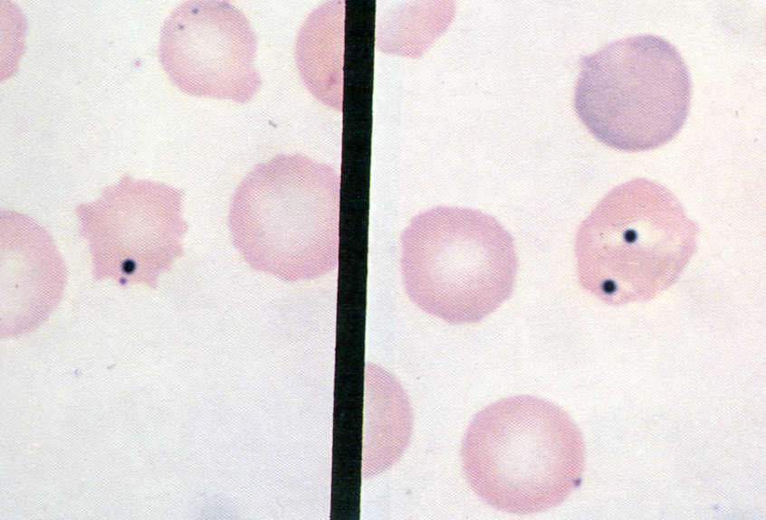 <p>Small, irregular magenta inclusions near the RBC periphery, often in clusters.</p>