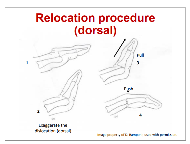 <p>Relocate Procedure </p>