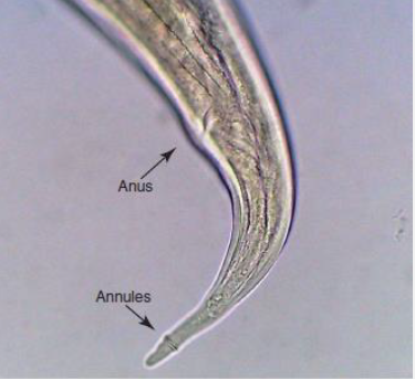 <p>Pictured is the tail of what Threadworm?</p>