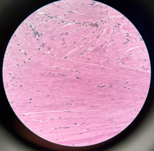 <p>ID tissue</p>