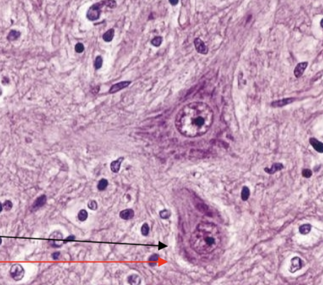 <p>GSE</p>