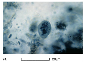 <p>What parasite is this (genus and species)?</p>