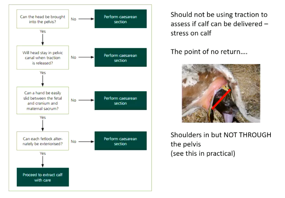 <p>Shoulders in but NOT THROUGH the pelvis (see this in practical)</p>