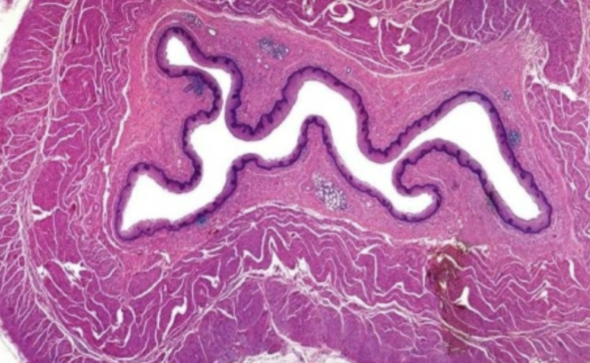 <p>What is this an image of?</p>