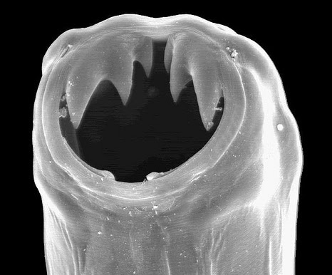 <p>Hookworm</p>