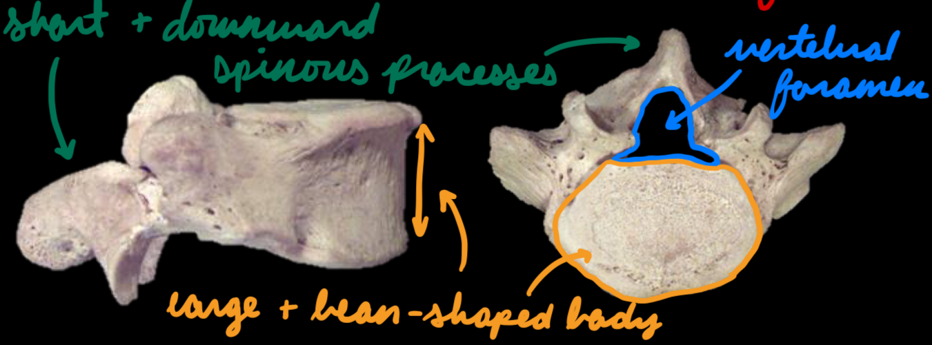 <p>L1-L5</p><p>Curvature: Lordosis</p><p>Vertebrae:</p><ul><li><p>Body: Large + bean-shaped</p></li><li><p>Spinous processes: Short + downward</p></li></ul><p></p>