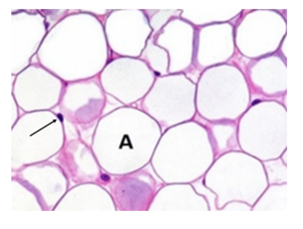 <p>identify this connective tissue</p>